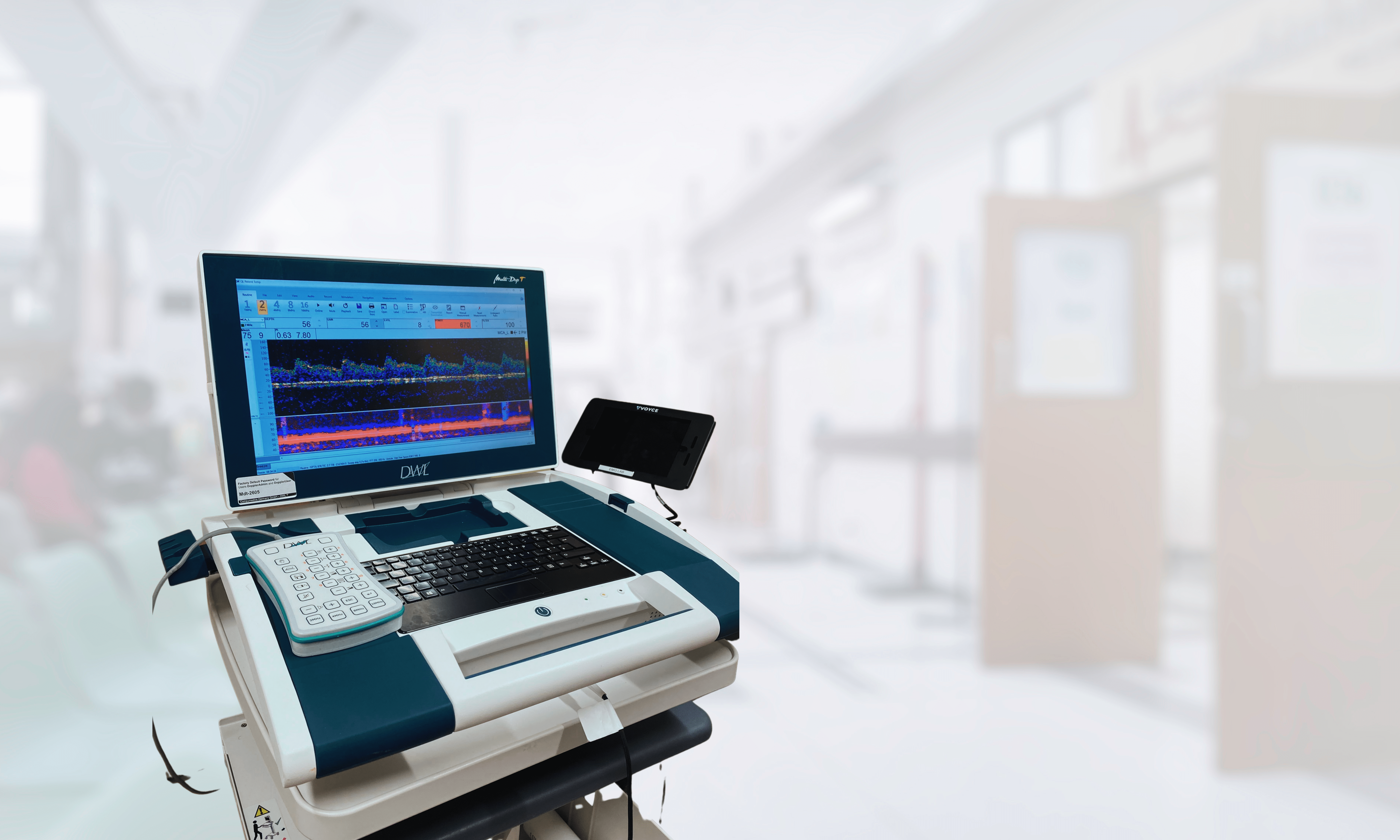 transcranial doppler ultrasound